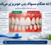 علت خونریزی لثه هنگام مسواک زدن
